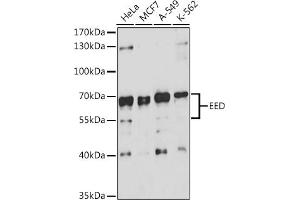 Western blot analysis of extracts of various cell lines, using EED antibody (ABIN6133691, ABIN6139940, ABIN6139943 and ABIN6216521) at 1:3000 dilution. (EED antibody  (AA 1-100))