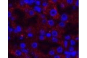 Immunofluorescence analysis of Mouse kidney tissue using AMACR Monoclonal Antibody at dilution of 1:200. (AMACR antibody)
