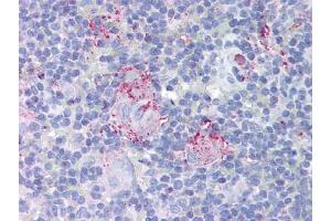 Image no. 1 for anti-Mdm2, p53 E3 Ubiquitin Protein Ligase Homolog (Mouse) (MDM2) antibody (ABIN302837) (MDM2 antibody)