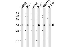 Western Blotting (WB) image for anti-Nuclear Factor of kappa Light Polypeptide Gene Enhancer in B-Cells Inhibitor, alpha (NFKBIA) (AA 1-30) antibody (ABIN389074)