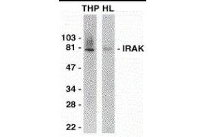 Western Blotting (WB) image for anti-Interleukin-1 Receptor-Associated Kinase 1 (IRAK1) (C-Term) antibody (ABIN2475130) (IRAK1 antibody  (C-Term))