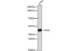 Western blot analysis of extracts of HeLa cells, using  Rabbit pAb (ABIN7265667) at 1:3000 dilution. (ASS1 antibody  (AA 1-412))