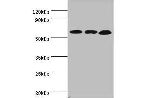 Western blot All lanes: Glutamate dehydrogenase 2, mitochondrial antibody at 4 μg/mL Lane 1: Mouse brain tissue Lane 2: 293T whole cell lysate Lane 3: Rat brain tissue Secondary Goat polyclonal to rabbit IgG at 1/10000 dilution Predicted band size: 61 kDa Observed band size: 61 kDa (GLUD2 antibody  (AA 319-558))