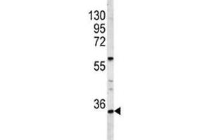 Western blot analysis of HOXA9 antibody and A2058 lysate. (HOXA9 antibody  (AA 245-272))