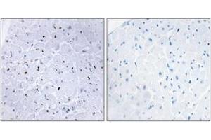 Immunohistochemistry analysis of paraffin-embedded human heart, using 53BP1 (Phospho-Ser6) Antibody. (TP53BP1 antibody  (pSer6))
