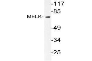 Western blot (WB) analysis of MELK antibody in extracts from k562 cells. (MELK antibody)