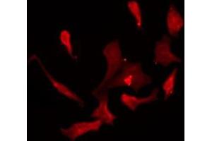 ABIN6275380 staining NIH-3T3 by IF/ICC. (KCND1 antibody  (C-Term))