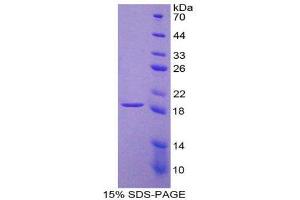 SDS-PAGE (SDS) image for Laminin, beta 2 (Laminin S) (LAMB2) (AA 1178-1311) protein (His tag) (ABIN1879741) (LAMB2 Protein (AA 1178-1311) (His tag))