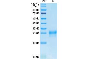 VEGFC Protein (AA 103-227) (His-Avi Tag)