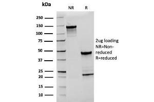 SDS-PAGE Analysis Purified CD27 Recombinant Mouse Monoclonal Antibody (rLPFS2/1611). (Recombinant CD27 antibody)