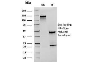 SDS-PAGE Analysis Purified CD27 Recombinant Mouse Monoclonal Antibody (rLPFS2/1611).
