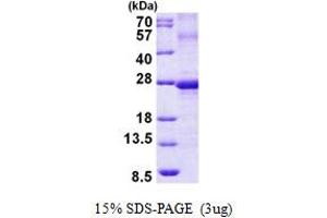 SDS-PAGE (SDS) image for Ephrin A3 (EFNA3) (AA 23-214) protein (His tag) (ABIN5852970)