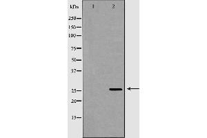 Western blot analysis of Hela whole cell lysates, using GSTM2 Antibody. (GSTM2 antibody  (C-Term))
