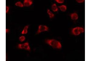 ABIN6278614 staining HeLa by IF/ICC. (OR5H6 antibody  (Internal Region))