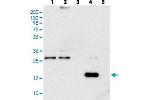 Western blot analysis of Lane 1: RT-4, Lane 2: U-251 MG, Lane 3: Human Plasma, Lane 4: Liver, Lane 5: Tonsil with RWDD4A polyclonal antibody .