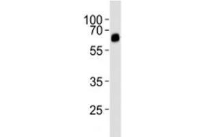 Western Blotting (WB) image for anti-Bone Morphogenetic Protein Receptor 1A (BMPR1A) (AA 30-60) antibody (ABIN3030186)