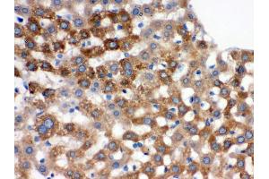 Immunohistochemistry (Paraffin-embedded Sections) (IHC (p)) image for anti-Transferrin (TF) (AA 20-49), (N-Term) antibody (ABIN3043419) (Transferrin antibody  (N-Term))
