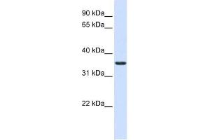 TXNDC14 antibody used at 1 ug/ml to detect target protein.