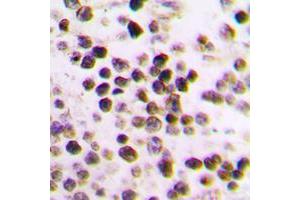 Immunohistochemical analysis of Cullin 3 staining in human tonsil formalin fixed paraffin embedded tissue section. (Cullin 3 antibody  (N-Term))