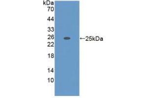 Western blot analysis of recombinant Mouse ADAMTS7. (ADAMTS7 antibody  (AA 226-437))
