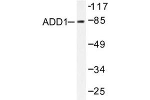 Image no. 2 for anti-Adducin 1 (Alpha) (ADD1) antibody (ABIN265301) (alpha Adducin antibody)