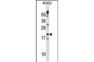 Western blot analysis in K562 cell line lysates (35ug/lane). (Cardiotrophin 1 antibody  (C-Term))