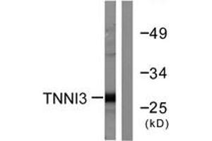 Western blot analysis of extracts from mouse heart cells, using TNNI3 (Ab-22/23) Antibody. (TNNI3 antibody  (AA 5-54))