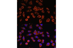 Immunofluorescence analysis of L929 cells using PIGM antibody (ABIN7269294) at dilution of 1:100.