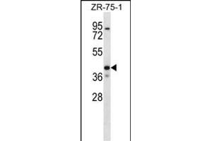 KCNK1 Antibody (C-term) (ABIN656655 and ABIN2845896) western blot analysis in ZR-75-1 cell line lysates (35 μg/lane).