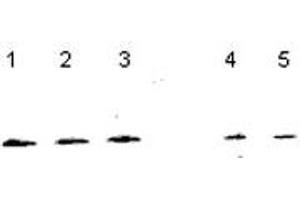 Western blot analysis of NUDT1 in NT2 cells (Lanes 1-3), and 833K64Cp9 cells (Lanes 4-5) with NUDT1 polyclonal antibody .