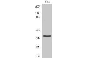 Western Blotting (WB) image for anti-Cysteinyl Leukotriene Receptor 2 (CYSLTR2) (C-Term) antibody (ABIN3184211) (CasLTR2 antibody  (C-Term))