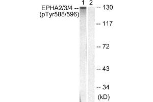 Western blot analysis of extracts from HepG2 cells, using EPHA2/3/4 (Phospho-Tyr588/596) antibody. (EPHA2/3 antibody  (pTyr588, pTyr596))