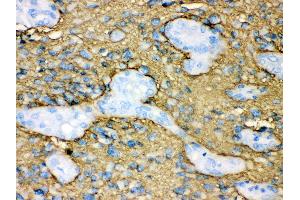 Anti- Aquaporin 4 Picoband antibody, IHC(P) IHC(P): Human Glioma Tissue (Aquaporin 4 antibody  (C-Term))