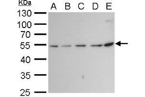 WB Image beta Tubulin 2 antibody detects beta Tubulin 2 protein by western blot analysis. (TUBB2A antibody)