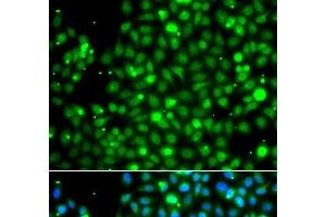 Immunofluorescence analysis of A549 cells using NME2 Polyclonal Antibody (NME2 antibody)