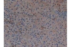 IHC-P analysis of Rat Adrenal Gland Tissue, with DAB staining. (TXNRD1 antibody  (AA 208-433))