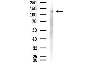 anti-KPB1/2 (Internal Region) antibody