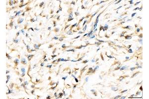IHC analysis of AP2A2 using anti-AP2A2 antibody (ABIN7602295).