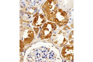 Immunohistochemical analysis of paraffin-embedded H. (LIMK2 antibody  (C-Term))