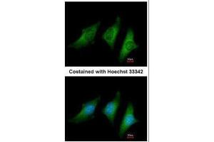ICC/IF Image Immunofluorescence analysis of methanol-fixed HeLa, using CD55, antibody at 1:200 dilution. (CD55 antibody  (Center))
