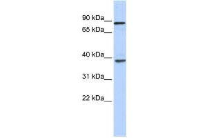 Western Blotting (WB) image for anti-DEAH (Asp-Glu-Ala-His) Box Polypeptide 35 (DHX35) antibody (ABIN2458247) (DHX35 antibody)