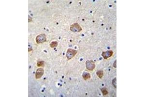 Formalin fixed, paraffin embedded human brain tissue stained with DBH Antibody (N-term) AP51191PU-N followed by peroxidase conjugation of the secondary antibody and DAB staining.