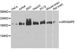 Western blot analysis of extracts of various cell lines, using ARHGAP5 antibody.