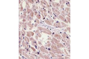 Immunohistochemistry (Paraffin-embedded Sections) (IHC (p)) image for anti-Protein Kinase N1 (PKN1) (AA 836-870) antibody (ABIN6242529)