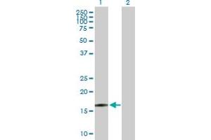Western Blot analysis of RTKN2 expression in transfected 293T cell line by RTKN2 MaxPab polyclonal antibody. (RTKN2 antibody  (AA 1-163))
