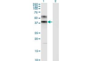 Western Blot analysis of ART3 expression in transfected 293T cell line by ART3 monoclonal antibody (M09), clone 1D2. (ART3 antibody  (AA 29-138))