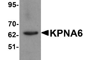 Western blot analysis of KPNA6 in 293 cell lysate with KPNA6 antibody at 1 µg/mL.