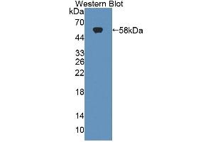 Figure. (Tenascin R antibody  (AA 329-588))