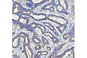 IHC analysis of DDX6 using anti-DDX6 antibody (ABIN7602044). (DDX6 antibody  (AA 56-483))