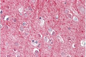 ABIN571009 (3. (CD90 antibody  (Internal Region))